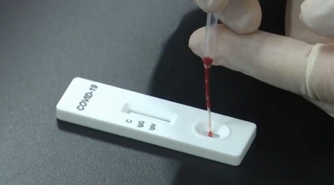 Artık, Korona Testi Evde Yaptırılabilinecek