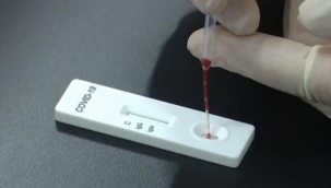 Artık, Korona Testi Evde Yaptırılabilinecek