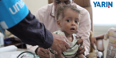 "Çocuk Ölümlerinin Yarısının Nedeni Gizli Açlık"